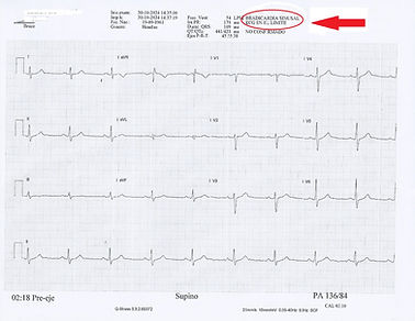 Examen electrocardiograma